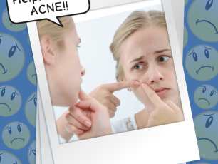 HOW DO I GET RID OF ACNE??