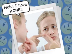 HOW DO I GET RID OF ACNE??