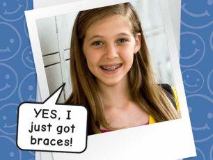 MISS BRACE FACE